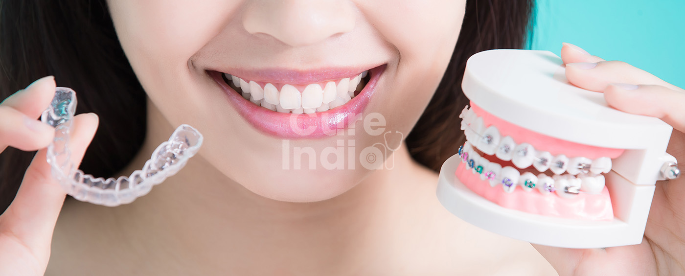 Orthodontic