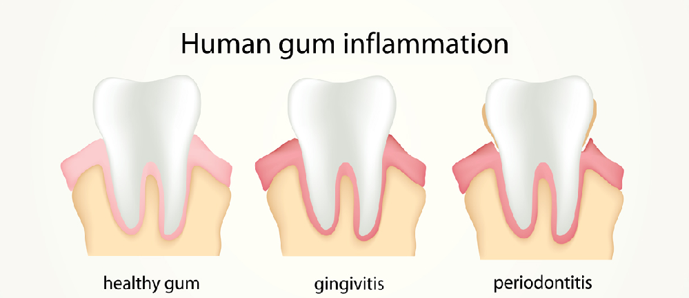 Periodontics