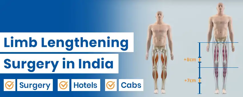 Limb Lengthening Surgery