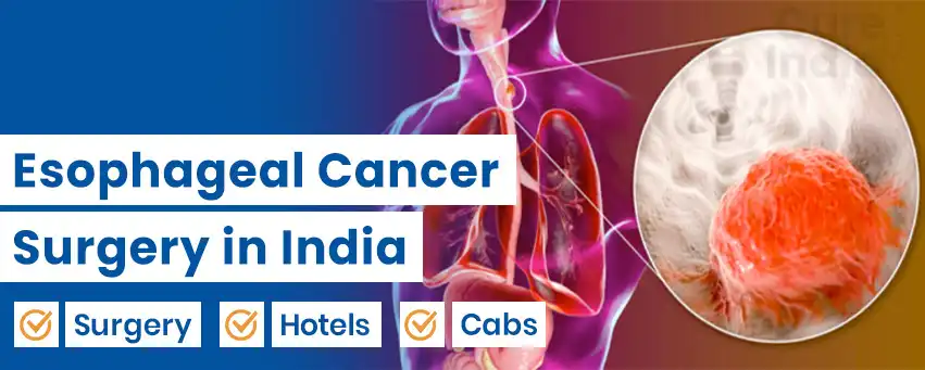 Esophageal Cancer