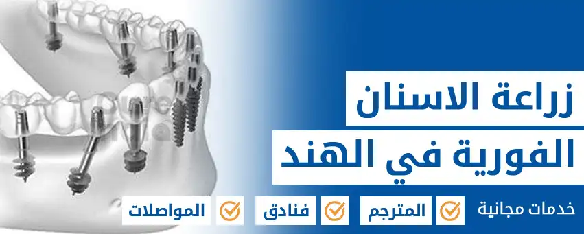 زراعة  الاسنان الفورية