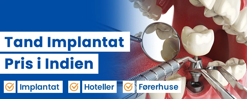 Tandimplantat Pris for Hele Munden