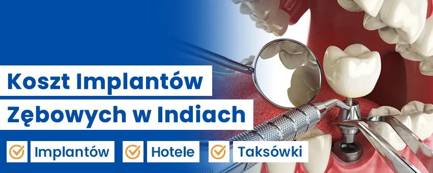 Koszt Implantów Zębowych