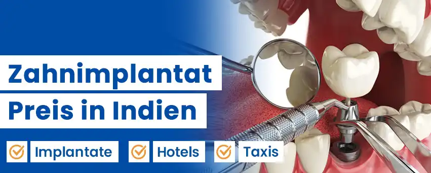 Zahnimplantat Preis