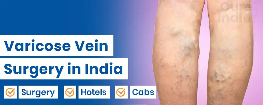 Varicose Vein Surgery