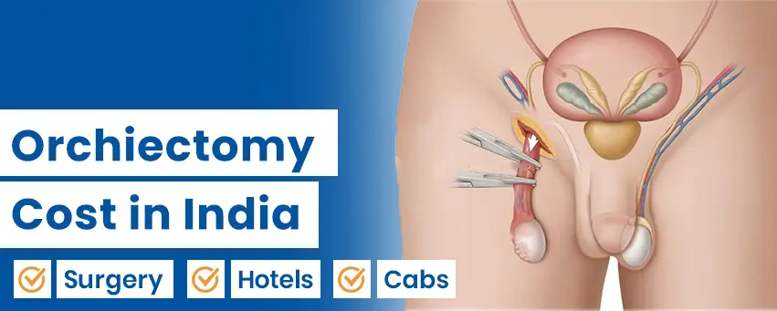 Orchidectomy Cost