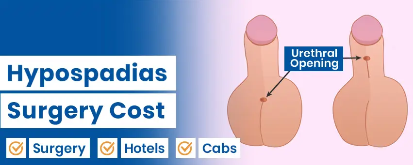 Hypospadias Surgery Cost