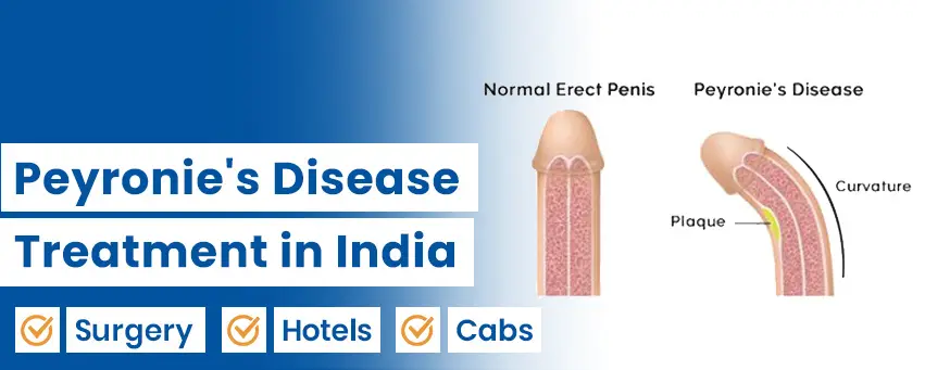 Peyronie's Disease