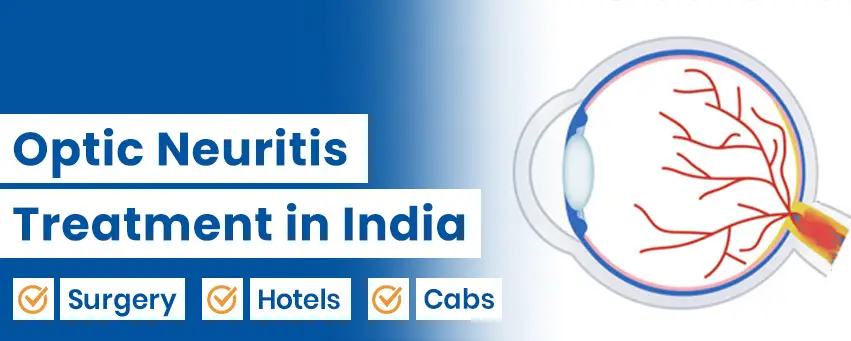 Optic Neuritis