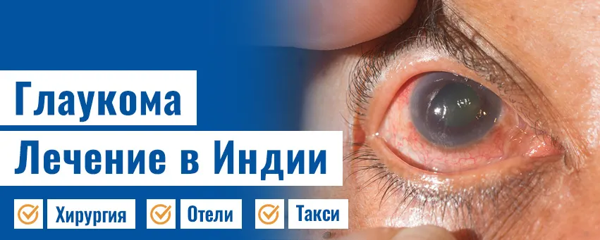 Глаукома лечение
