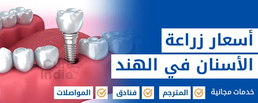 أسعار زراعة الأسنان