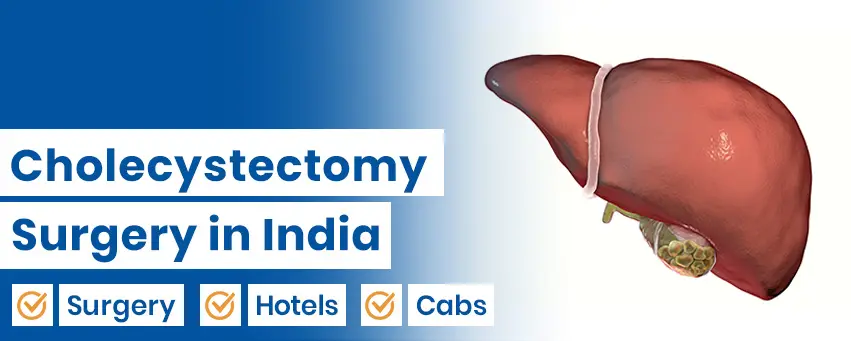 Cholecystectomy Surgery