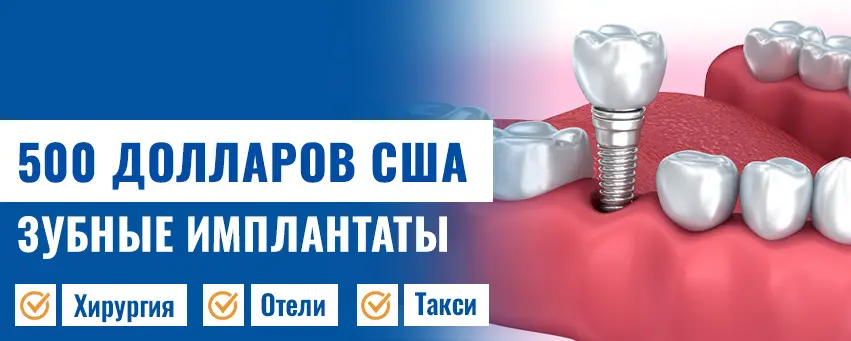 Имплантация зубов цена