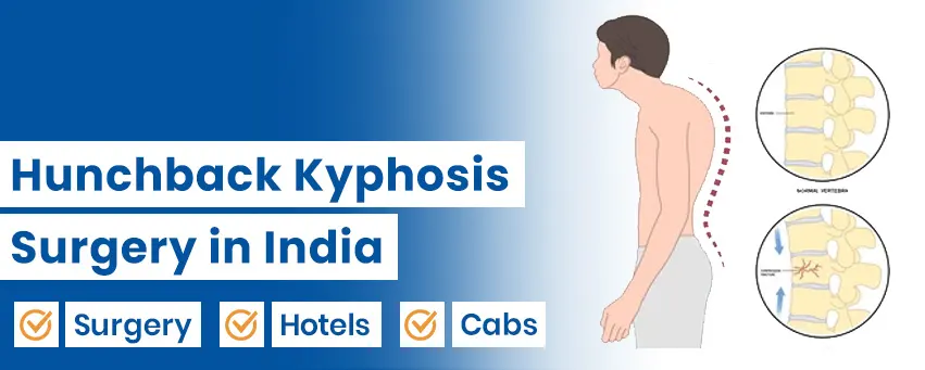 Hunchback Kyphosis