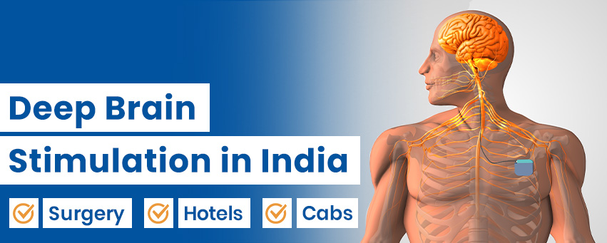 Deep Brain Stimulation
