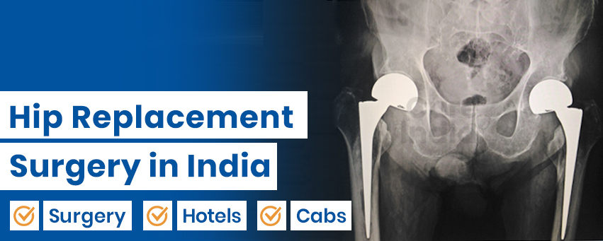 Total Hip Replacement