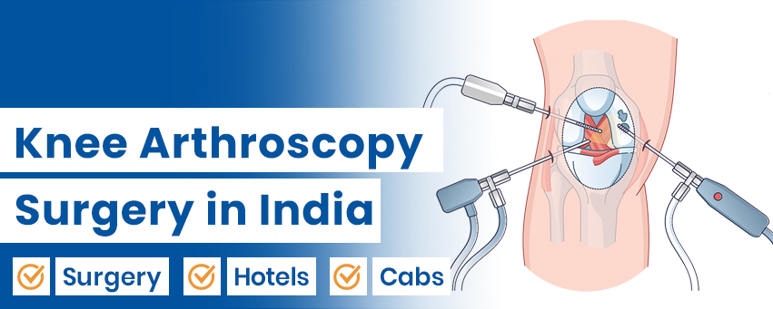 Knee Arthroscopy