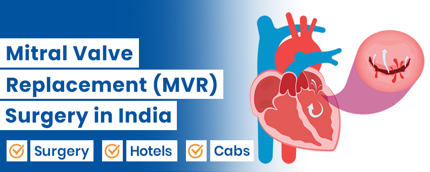 Mitral Valve Replacement Surgery