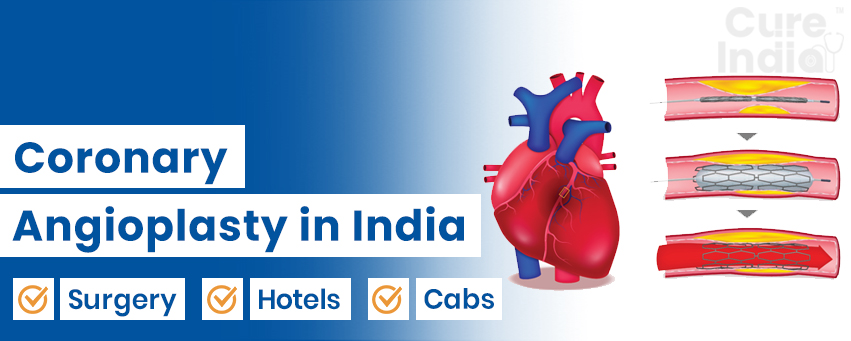 Coronary Angioplasty