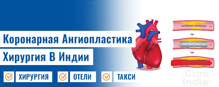 Коронарная ангиопластика