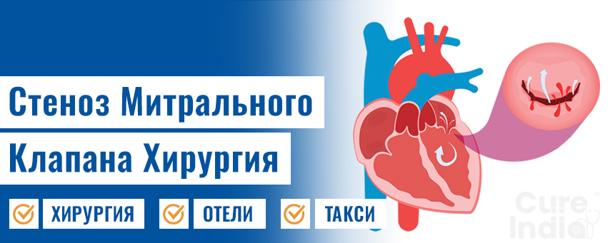 Хирургия митрального клапана