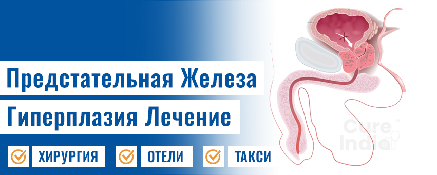 Предстательная Железа Гиперплазия