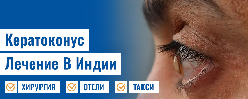 Кератоконус Лечение