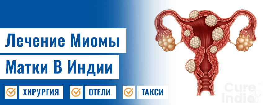 Фибромиома Матки Лечение