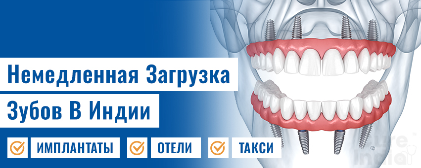 Немедленная Нагрузка