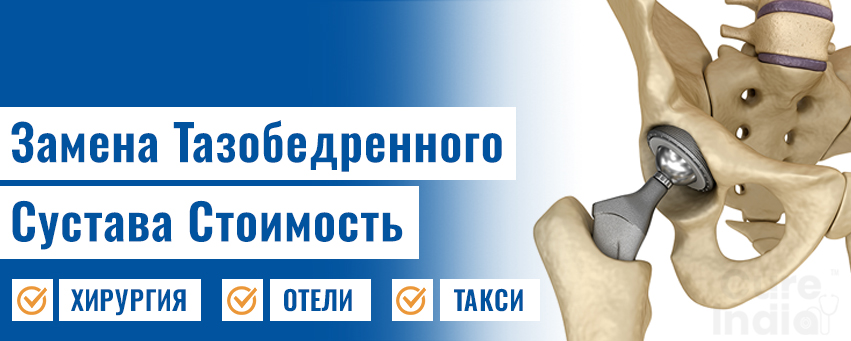 Замена Тазобедренного Сустава Стоимость