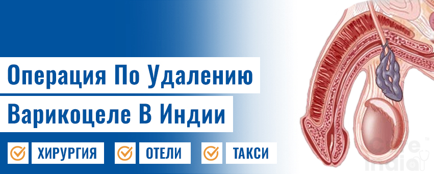 Операция По Удалению Варикоцеле