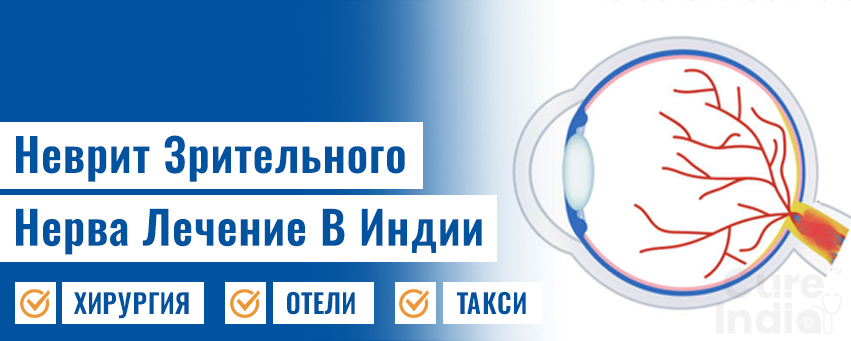 Неврит Зрительного Нерва