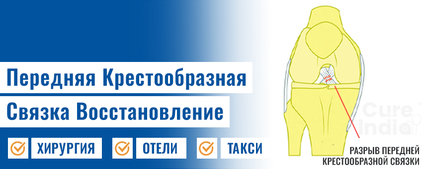 Передняя Крестообразная Связка Восстановление