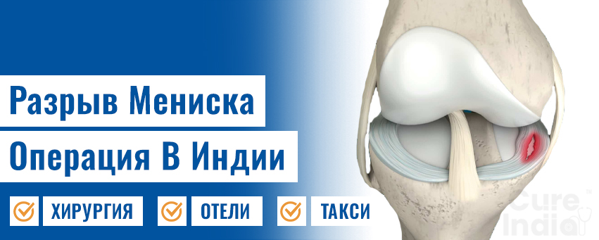 Разрыв Мениска Операция