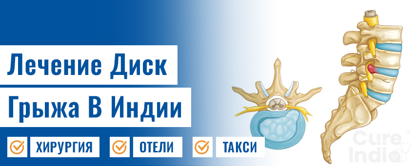 Лечение Диск Грыжа
