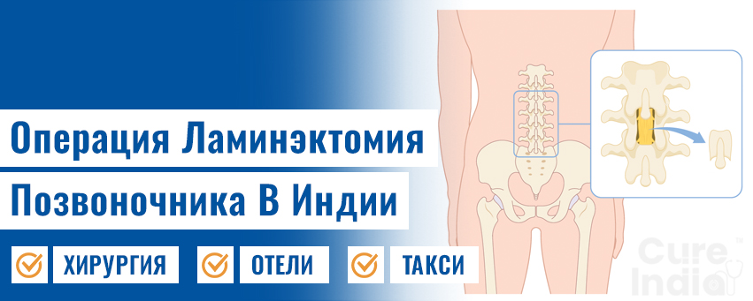 Шейная Ламинэктомия