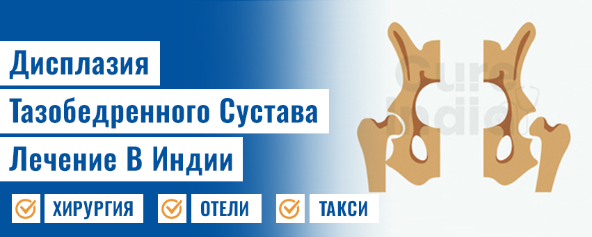 Дисплазия тазобедренного сустава