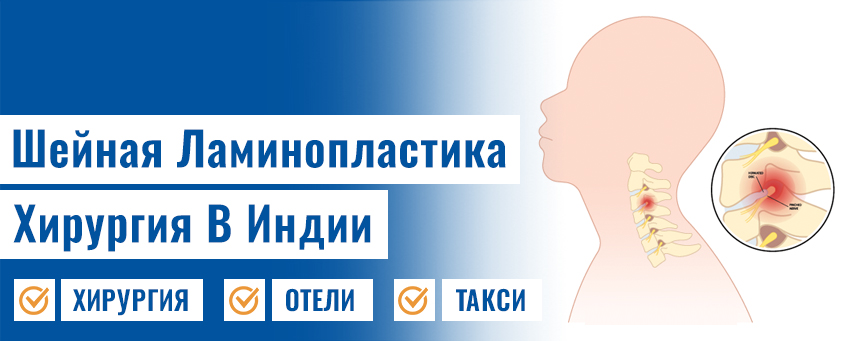 Шейная ламининопластика