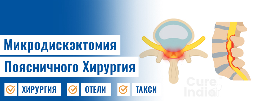 Микродискэктомия Поясничного