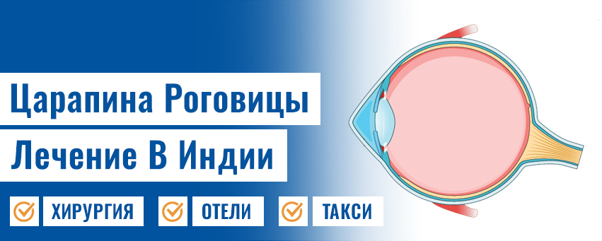 Царапина Роговицы