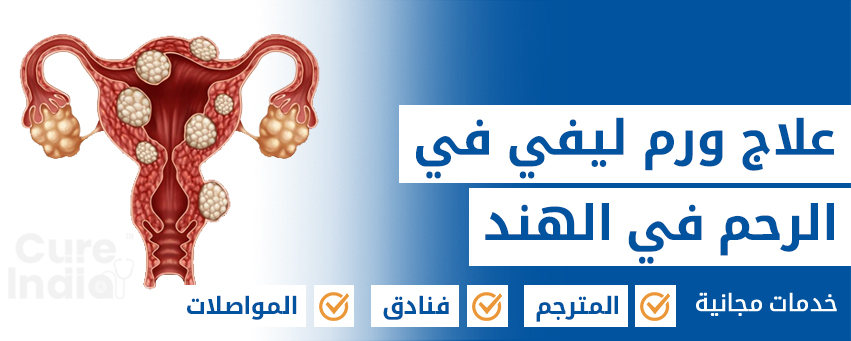 علاج ورم ليفي في الرحم