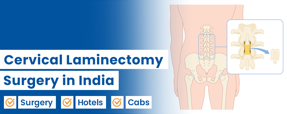 Cervical Laminectomy