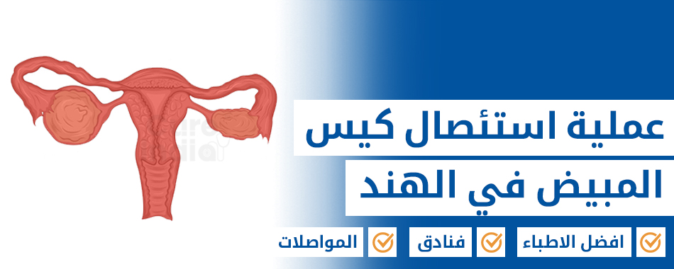 كيس المبيض