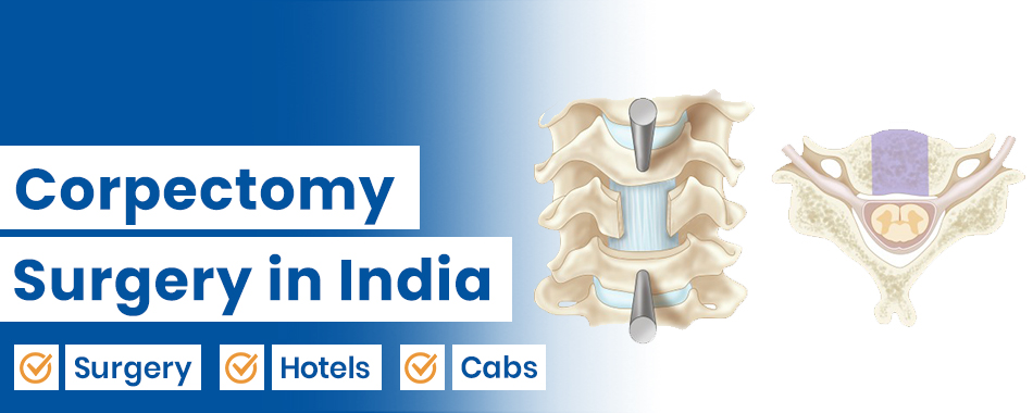 Corpectomy Surgery