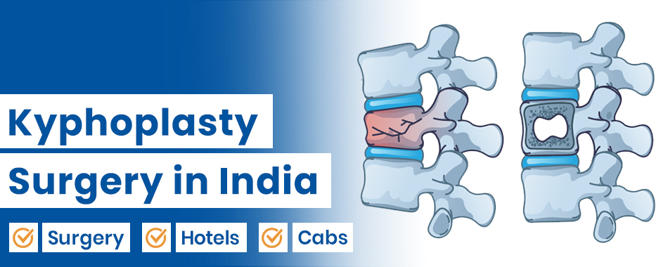 Kyphoplasty Surgery