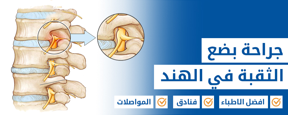 جراحة بضع الثقبة
