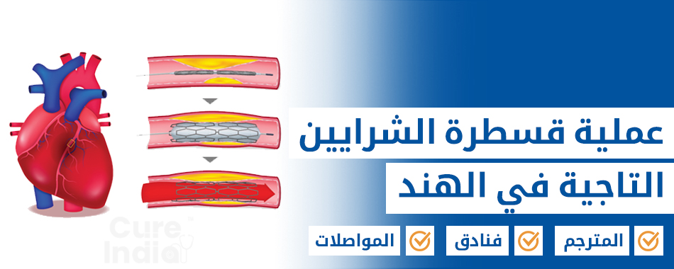 قسطرة الشريان التاجي