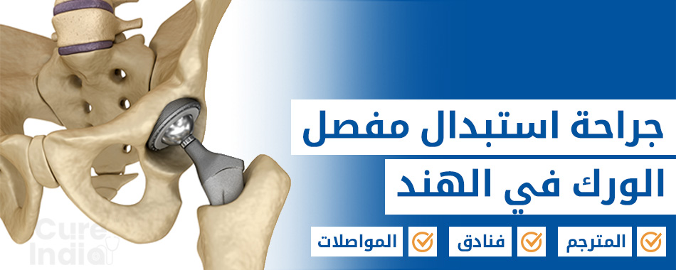 زراعة مفصل الورك
