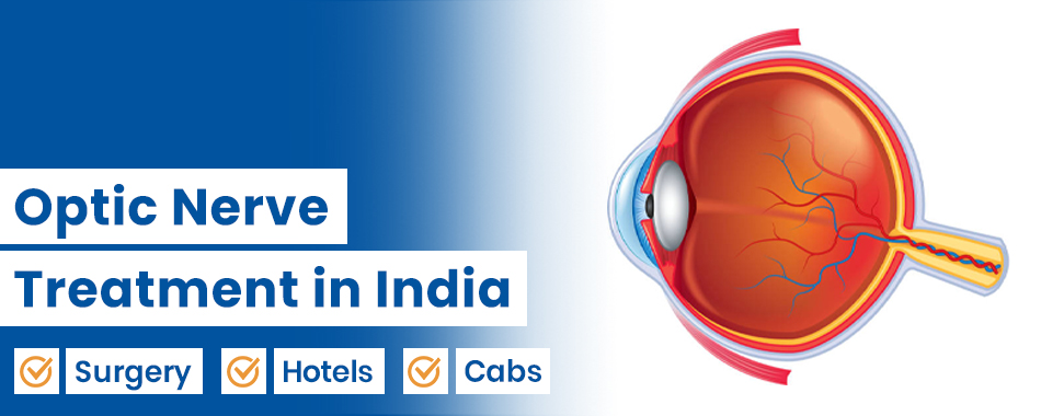 Optic Nerve