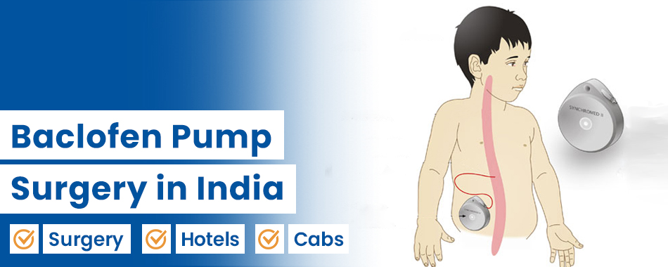Baclofen Pump